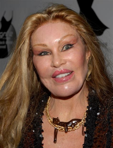 plastic surgery catwoman dies.